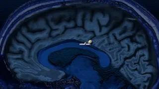 Chronic ischemic small vessel disease and chronic ischemic white matter changes explained.