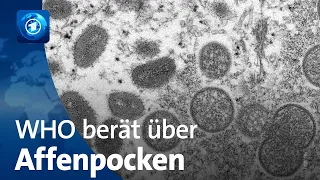 Affenpocken - WHO überprüft Gesundheitsnotstand