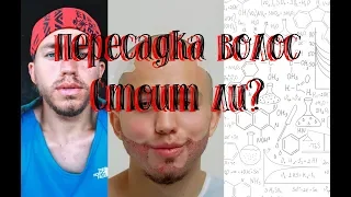 7 МЕСЯЦЕВ ПОСЛЕ ОПЕРАЦИИ ПЕРЕСАДКИ БОРОДЫ: СЕРГЕЙ РОМАНОВИЧ И ЕГО БОРОДА СЕГОДНЯ