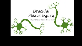 Brachial Plexus Injury - Erb's palsy and Klumpke's palsy