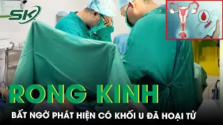 Đau Bụng, Rong Kinh Bất Thường, Người Phụ Nữ Được Phát Hiện Có Khối U Đã Hoại Tử | SKĐS