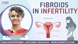 Fibroids in Infertility - ZIVA Fertility English - Dr. Chekuri Suvarchala Vardhan