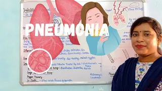 Pharmacotherapy of Pneumonia | Definition | Sign & Symptoms  | Diagnosis | Risk Factor | Treatment