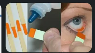 Flourecein Strips || Uses || Optometry solution