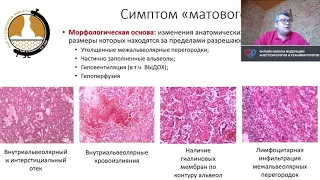 COVID 19  у беременных Силаев Б В