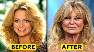 20 Celebrities Who Have Aged Badly