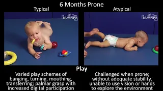 6 Month Old Baby Typical & Atypical Development Side by Side