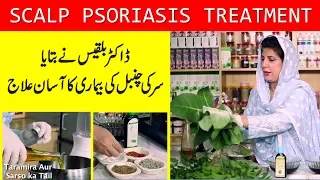 Scalp Psoriasis Treatment by Dr. Bilquis | Chambal ka Ilaaj | چنبل کی بیماری کا علاج