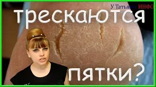 Вай Вай Вай ПЯТКИ трескаются! Что делать? :(