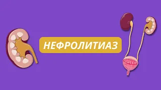 Нефролитиаз (Почечнокаменная болезнь), виды камней, физиология образования, лечение