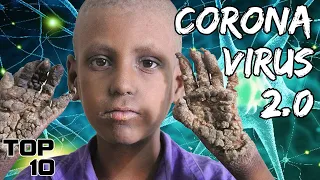 Top 10 Scary Diseases With Unknown Origins