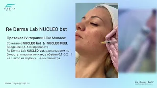 Процедура Like Monaco. Смарт PDRN. Re Derma PEEL NUCLEO & Re Derma Lab NUCLEO bst. Майшанова О.С.