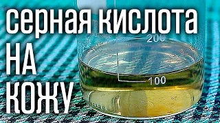 🔥 Что будет если серная кислота попадет на кожу? Первая помощь при ожогах.