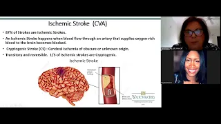 Stroke, CVA Warning Signs 2