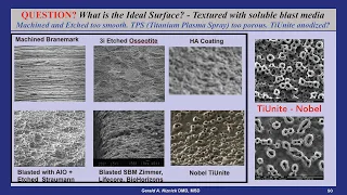 What is the ideal implant surfaces? Machine → AlO₂ Blasted/Etched → HA → SBM → Anodized