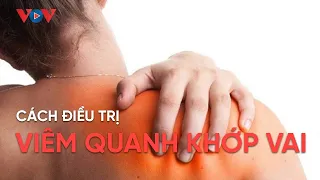 Viêm quanh khớp vai: Dấu hiệu nhận biết, nguyên nhân và cách điều trị