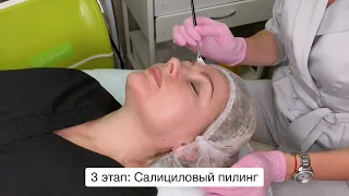 Салициловый пилинг