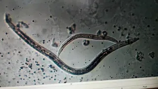 Nematoda