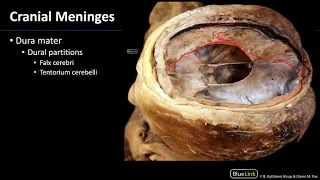 Cranial Cavity and Brain - Meninges and Dural Partitions