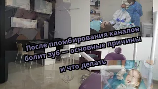 После пломбирования каналов болит зуб — основные причины и что делать