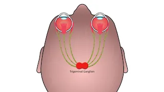 The neurolens® System