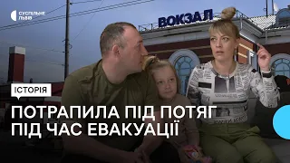 Невдало протезувалась у Норвегії та повернулась додому: мешканка Марганця розповіла свою історію