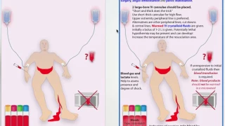 Trauma Part 7 - Circulation - Management in Trauma Patients