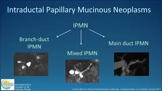 Approach to Cystic Lesions of the Pancreas