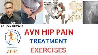 Learn About Hip Pain Due to AVN| Causes ,Treatment and Exercises For AVN of Hip Joint|Urdu|Hindi