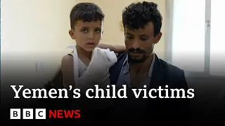 Child victims of Yemen’s civil war - BBC News