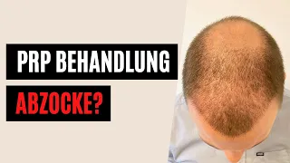 Meine Erfahrung mit PRP Behandlung bei Haarausfall (Elithair)