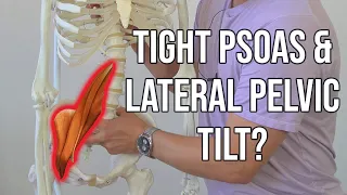 Lateral Pelvic Tilt and TIGHT PSOAS Exercises - 4-Step Progression