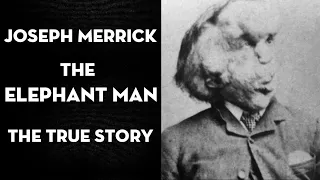 Joseph Merrick (The Elephant Man) The true story