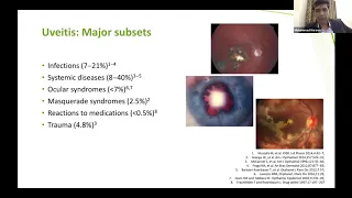 NON INFECTIOUS UVEITIS Dr MOHAMMED HAROON