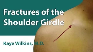 Fractures Of The Shoulder Girdle