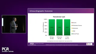 Innovations in TMVR and Intrepid trial updates - PCR London Valves 2022