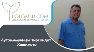 Аутоиммунный тиреоидит Хашимото. Фиброзный и специфический тиреоидиты