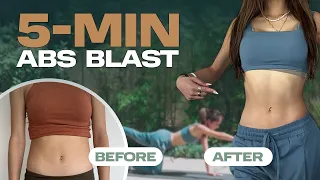 5 MIN ABS Challenge: Total Core Transformation! 💪🔥