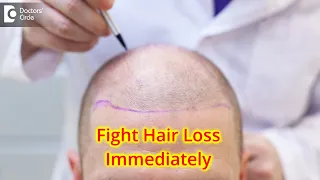 Hair loss treatment | Hair loss causes and regrowth treatments -Dr. Somashekar Gejje|Doctors' Circle