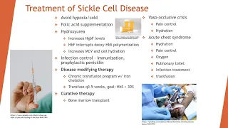 iPiece Sickle Cell Disease Part 3