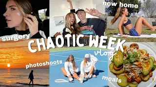 week vlog: MOVING, face surgery, photoshoots, etc.