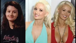 Holly Madison Then and Now 2018 (Plastic Surgey)
