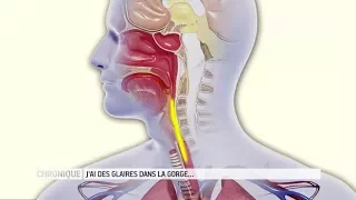 Glaires dans la gorge : comment s'en débarrasser ? - Le Magazine de la santé