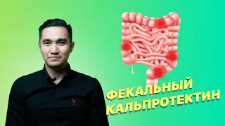 Что такое фекальный кальпротектин?