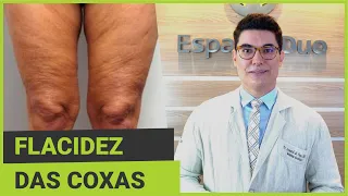 Flacidez das Coxas