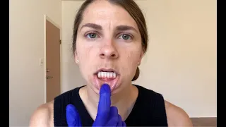 Tongue and Lip Ties - Myofunctional Therapy Self-Assessment