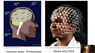 Ch 12 Part 3 Consciousness EEG and Memory