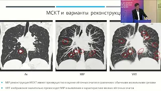 Стратегия лечения метастазов солидных опухолей в легких