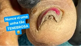 NUNCA VI UMA UNHA TÃO TENEBROSA 😵‍💫 Vídeo Narrado 😵