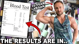 10 YEAR VEGAN FULL BLOOD TEST ANALYSIS WITH DOCTOR | AM I THRIVING OR NOT?